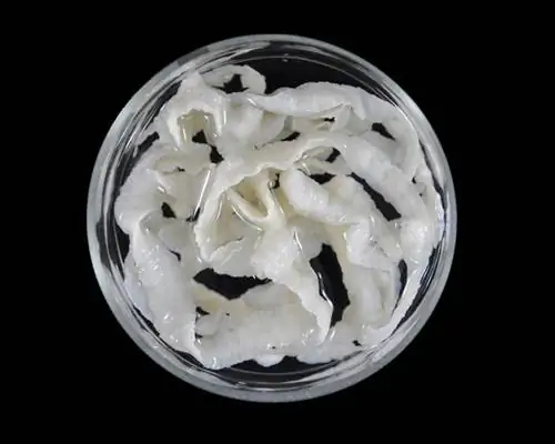 были-припадки-и-врачи-распространяли-только-руки-сканирование-мозга-раскрыло-правду