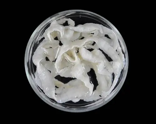 У него были судороги, и врачи разводили руками. Только сканирование мозга раскрыло правду