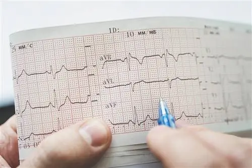 Наиболее распространенные врожденные пороки сердца у детей и взрослых