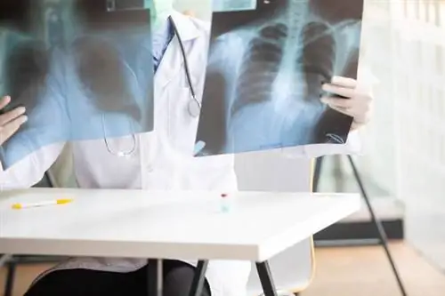 Пневмоторакс