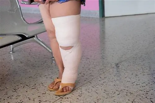 Слоновость – дефект зрения или серьезная проблема со здоровьем?