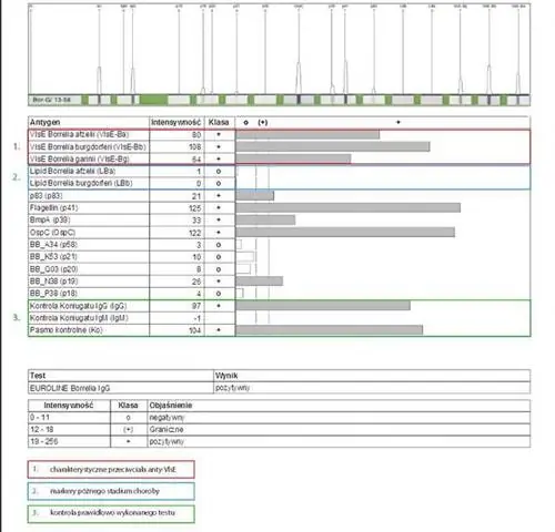 Правильный тест на болезнь Лайма