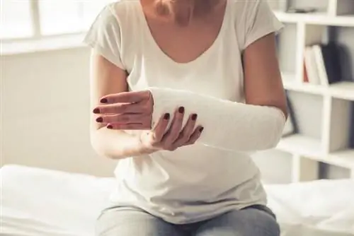 Перелом кисти представляет собой частичное или полное нарушение непрерывности кости.