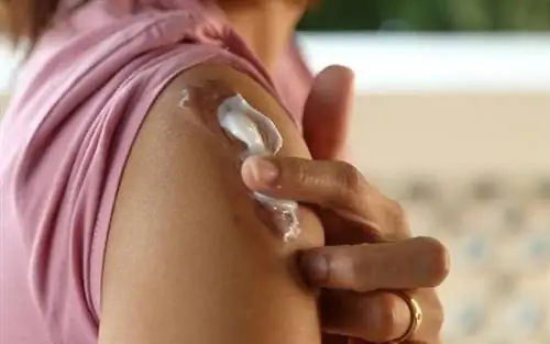 Шрам - как образуются шрамы, как их избежать и как избавиться от шрамов?