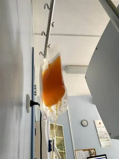 Рекордсмен по сдаче плазмы. «Каждый раз я могу спасти трех человек» 5