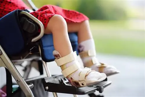 Существует препарат для пациентов со СМА