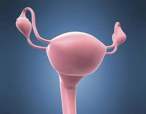 Непроходимость маточных труб и бесплодие. Причины и лечение непроходимости маточных труб