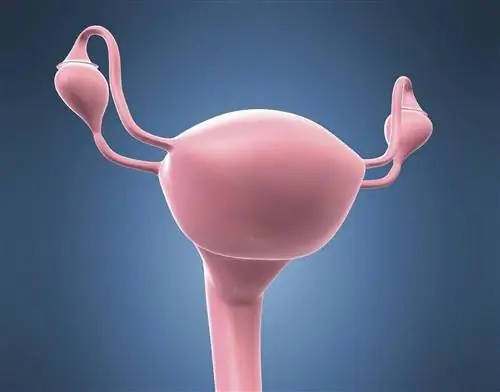 Непроходимость маточных труб и бесплодие. Причины и лечение непроходимости маточных труб