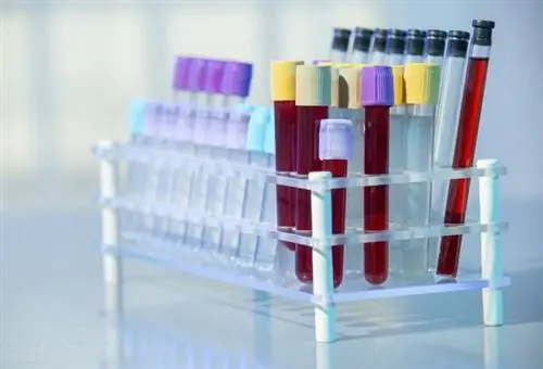 CA-125: онкомаркер. Тестирование, стандарты антигена CA-125