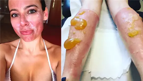 Солнце горит