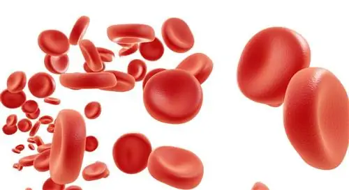 Гемолиз: причины, симптомы, лечение