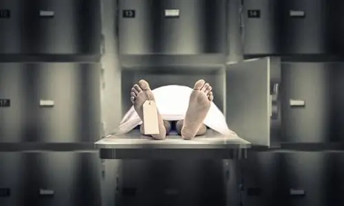 Синдром Лазаря