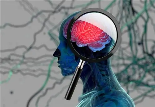 Нарушения мозгового кровообращения