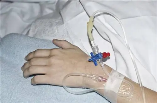 Сывороточная болезнь: причины, симптомы, лечение