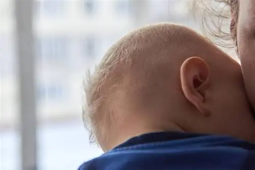 Синдром Аперта - причины, симптомы, лечение