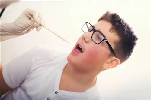 Аллергическая ангина или аллергический фарингит