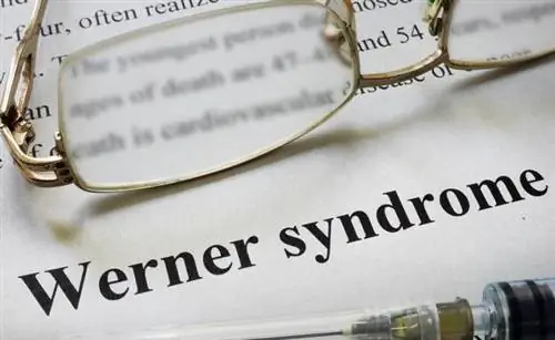 Синдром Вернера - причины, симптомы, диагностика, лечение