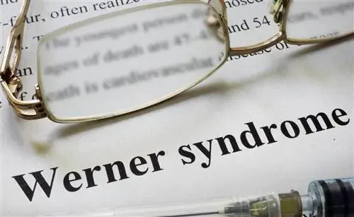 Синдром Вернера - причины, симптомы, диагностика, лечение