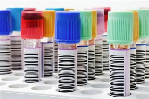 Тест fT4 - норм. Высокий и низкий fT4