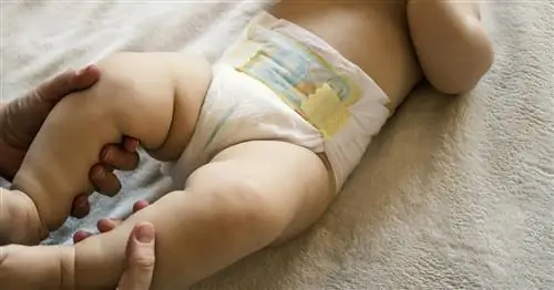 Исландский закон о запрете обрезания новорожденных сталкивается с религиозной реакцией