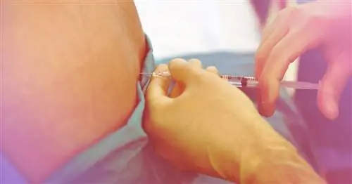 8 вещей, которые вы должны знать об эпидуральной анестезии