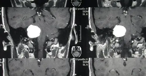 Я вдова и мать. Я учу сына искусству жизни после смерти