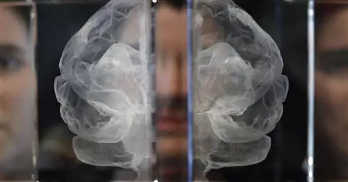 Окситоцин, дофамин и химия мозга в браке