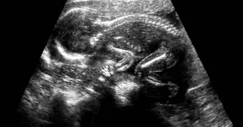 Когда дети начинают мечтать? Скорее всего в утробе