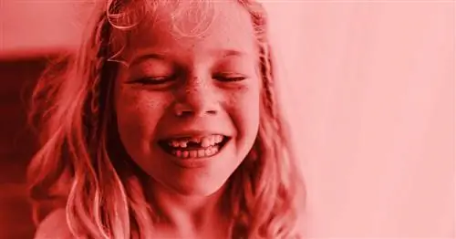 Дети и кариес: что родителям нужно знать о гнилых молочных зубах