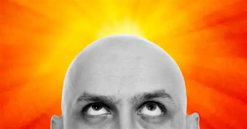 Почему солнечный ожог на лысине - худший солнечный ожог