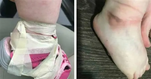 Родители в ярости после того, как детский сад привязал обувь малыша к ее лодыжкам