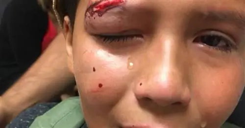 Люк Скайуокер хвалит ребенка, который отказался драться с хулиганами, потому что это не «Путь джедая»