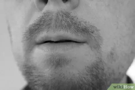 Напишите медицинское заключение и запланируйте шаг 7