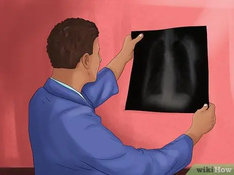 Доказать чрезмерное влияние Шаг 8