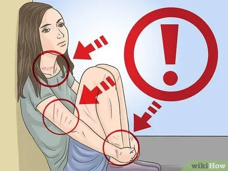 Выявление торговли людьми, шаг 2