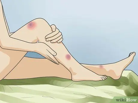 Распознавать признаки жестокого обращения Шаг 15