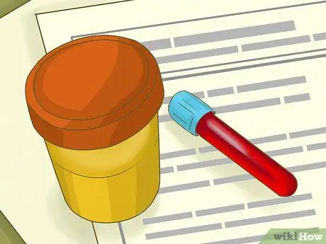 Пройти тест на табак, шаг 2