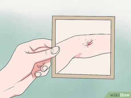 Выиграть дело о домашнем насилии Шаг 9