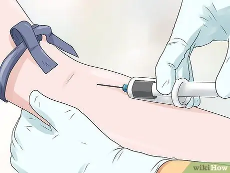 Расчет анионной щели, шаг 10