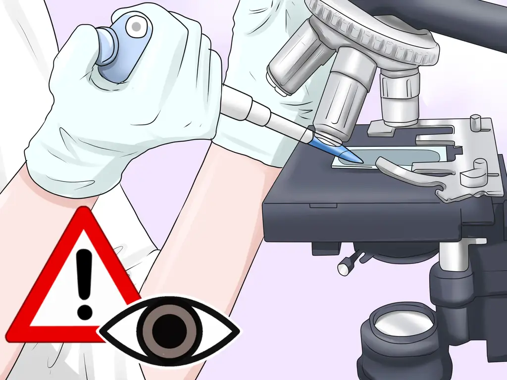 Как рассчитать анионный зазор: 12 шагов (с рисунками)