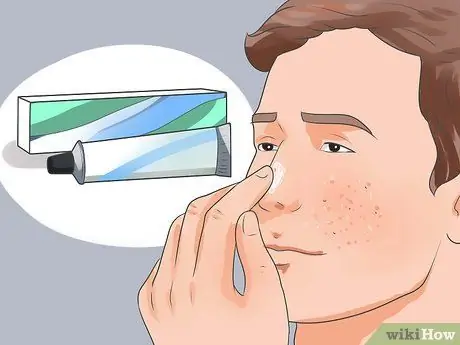 Вылечить прыщ Шаг 2 Вылечить прыщ Шаг 2