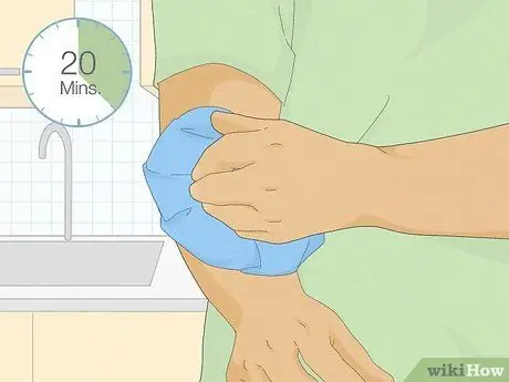 Вылечить укус огненного муравья Шаг 1