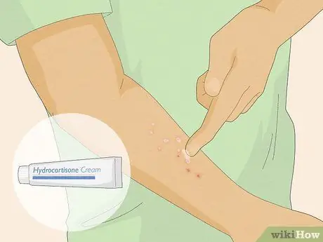 Вылечить укус огненного муравья Шаг 2