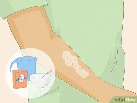 Лечить укус огненного муравья Шаг 3