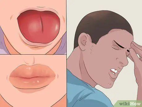 Лечить укус ската Шаг 3