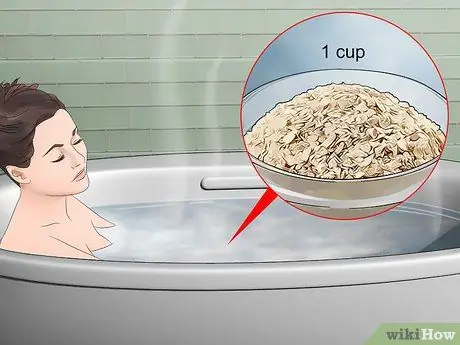 Лечить укусы дубового клеща Шаг 5