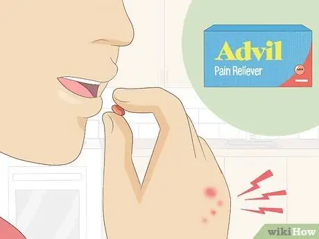 Лечить укусы клопов, шаг 11