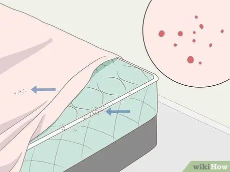 Лечить укусы клопов, шаг 3