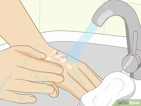 Лечить укусы клопов, шаг 6