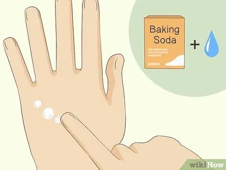 Лечить укусы клопов, шаг 7